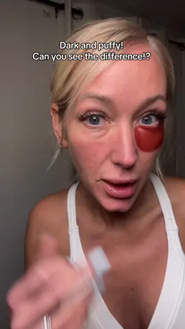 Caffeine and peptides are better together, just like me and this eye mask!#peptide #eyemask #puffinessundereyes #awake #brighteyesss #hyaluronicacid #darkundereye #eyebags #eyepuffiness #hangover #tierd 