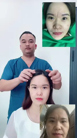 Xóa nhăn ấn đường vĩnh viễn #lamdep #xoanhan #xoanhananduong #donranhcuoi #donthaiduong #doncam #catmi #nangcungmay #nangmui #cangdamat #bshoangngoc #phauthuatthammy #phongthuy #nhantuong #xuhuong #foryoupage 