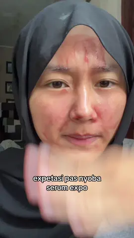 yg belum cobain nyesel sih @glad2glow.indo 