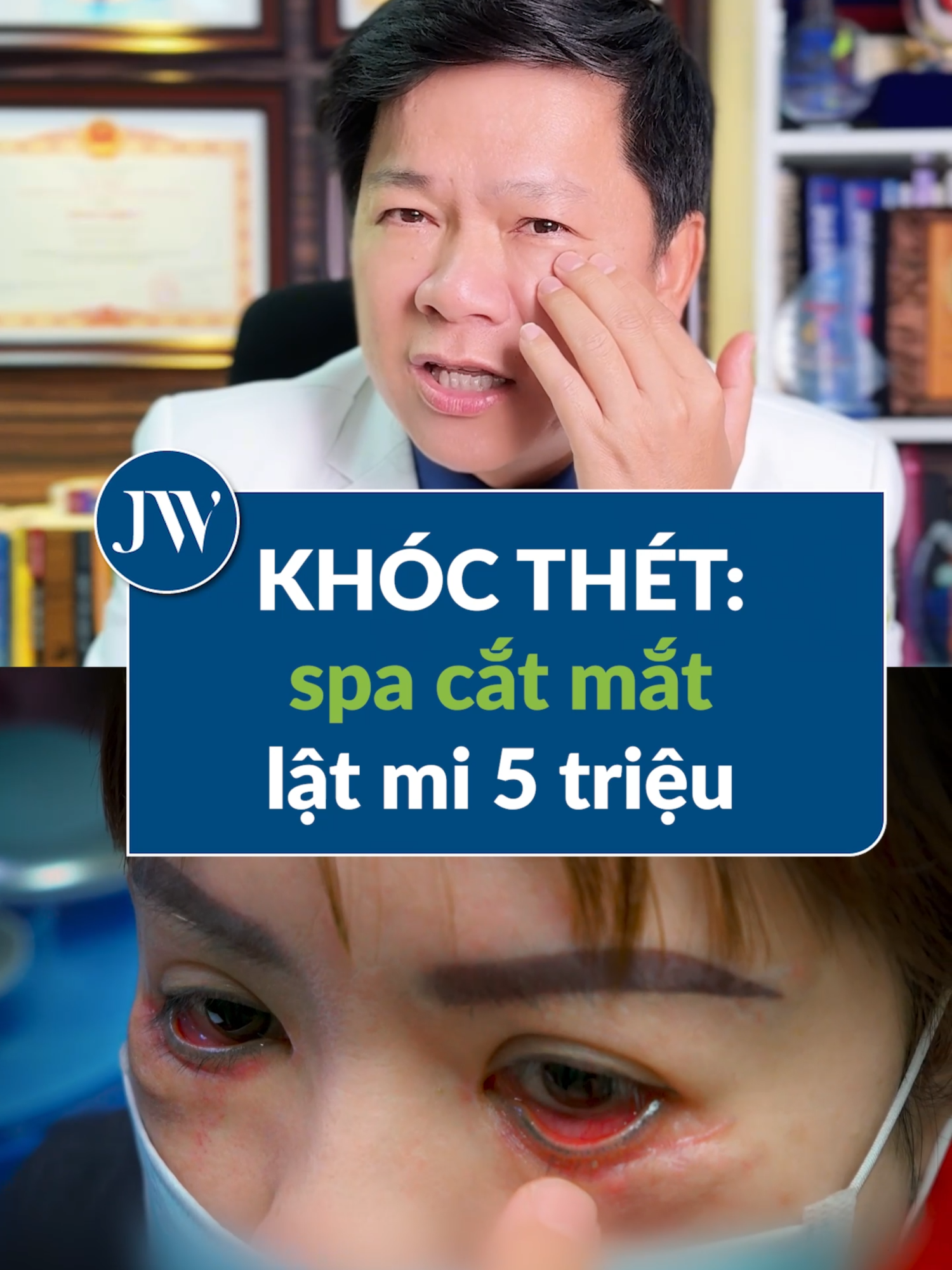 Bác sĩ Tú Dung BỨC XÚC spa chui cắt mắt 5 TRIỆU khiến quý cô MẮT LẬT MI không nhắm được #benhvienJW #bacsiTuDung #xuhuong #viral #phauthuatthammy #trending #bienchungthammy #spa