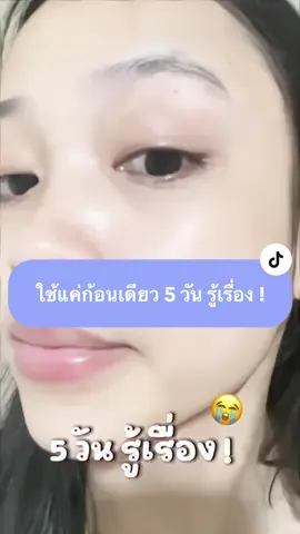 #สบู่เอวาน่า #หน้าใส #ลดสิว #pyf #ฟีด #เปิดการมองเห็น 