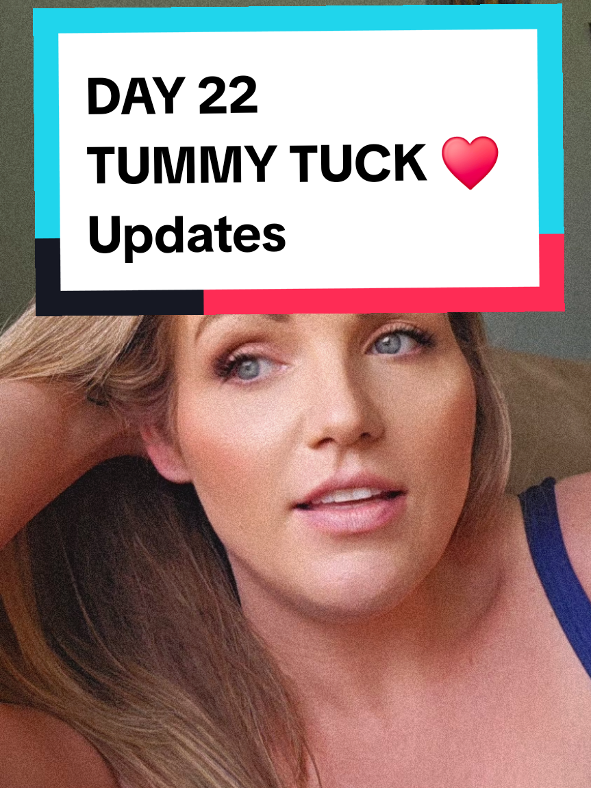 Day 22 post tummy tuck: still swollen, still sore, still healing—but making progress every day. Don’t believe the “bounce back” lies. This recovery is real. Follow for the raw truth. #TummyTuckRecovery #PostOpJourney #RealRecovery #DrainlessTummyTuck #HealingNotHustling #SurgeryTruths #Day22Healing #MommyMakeoverRecovery #NoFilterHealing #TikTokHealingJourney #letsbereal #day22 