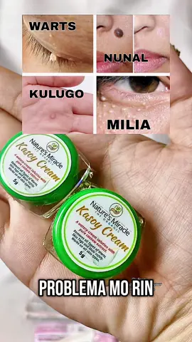 Problema mo ba ang buhay na nunal??? #kasoycream #kasoycreamwarts #nunalremoval #naturesmiraclewartsremoval #recommendations #fyp 