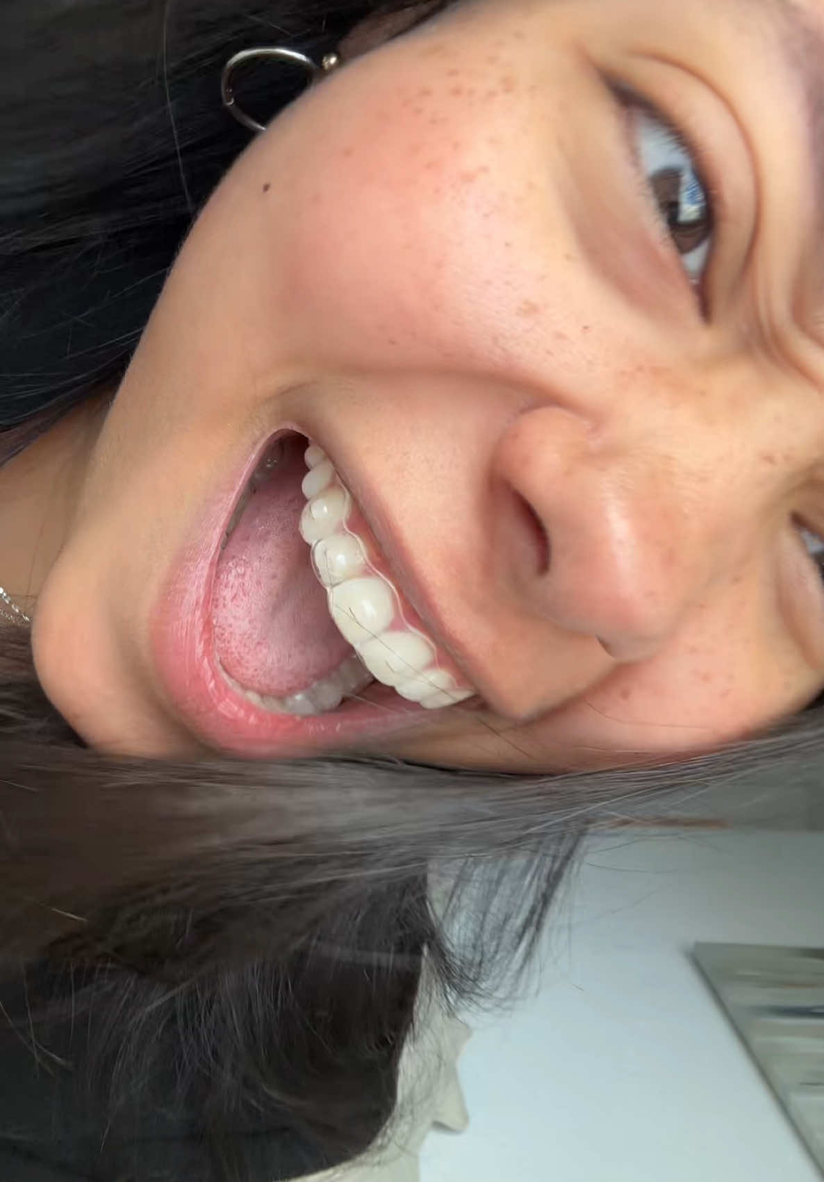 mas pecas q gente
