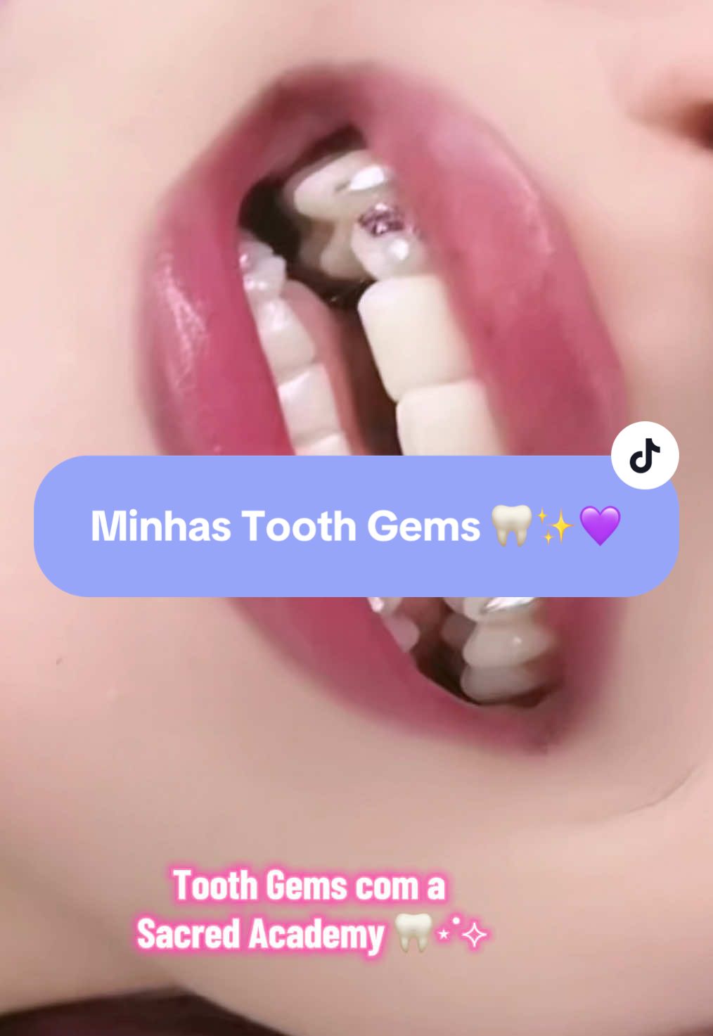Adoro tanto 🥺💜 Sempre com a Sacred Academy ✨ #Portugal #ToothGems #alt 
