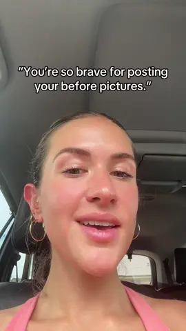 My body looking like millions of other women who have had three kids while on this earth isn’t that big of a deal #fyp 