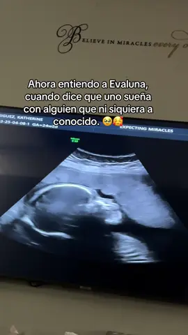 Mi vida 🥹🥰🧸 #pregnant #mamaprimeriza #embarazo #primeriza #bebedemama #pregnantlife #momlife #maternidad #maternity #bebeencamino #bebe #mibebe  #miniña #miniño #miniño   #CapCutAmor #mom #embarazo #embarazofeliz 