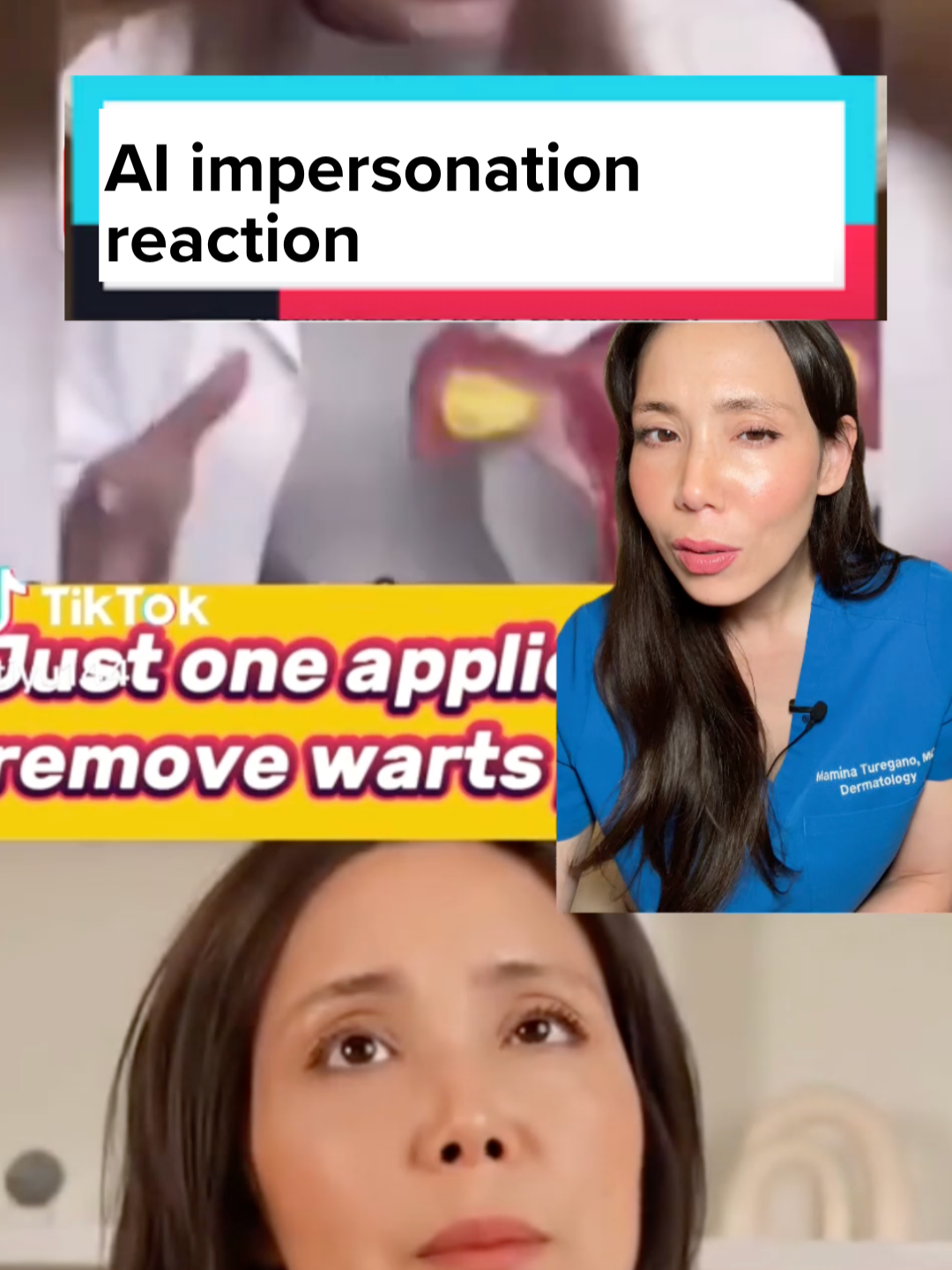 I WISH I was joking, but this is an AI-generated video using my ACTUAL FACE without my knowledge, without my consent, to promote a product I've never used, and would NEVER recommend... As a board-certified dermatologist, I've worked hard to educate people on SAFE skincare. So, seeing my image used to push harmful information is beyond upsetting. PLEASE be cautious, especially when it comes to skincare and medical products. Just because it looks like a trusted voice, doesn't mean it is... #ai #aigenerated #impersonation