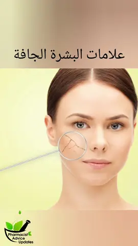 علامات البشرة الجافة #بشرة #البشرة #البشرة_الجافة #مرطب #ترطيب #pharmacist_advice_updates #pharmacistadviceupdates 