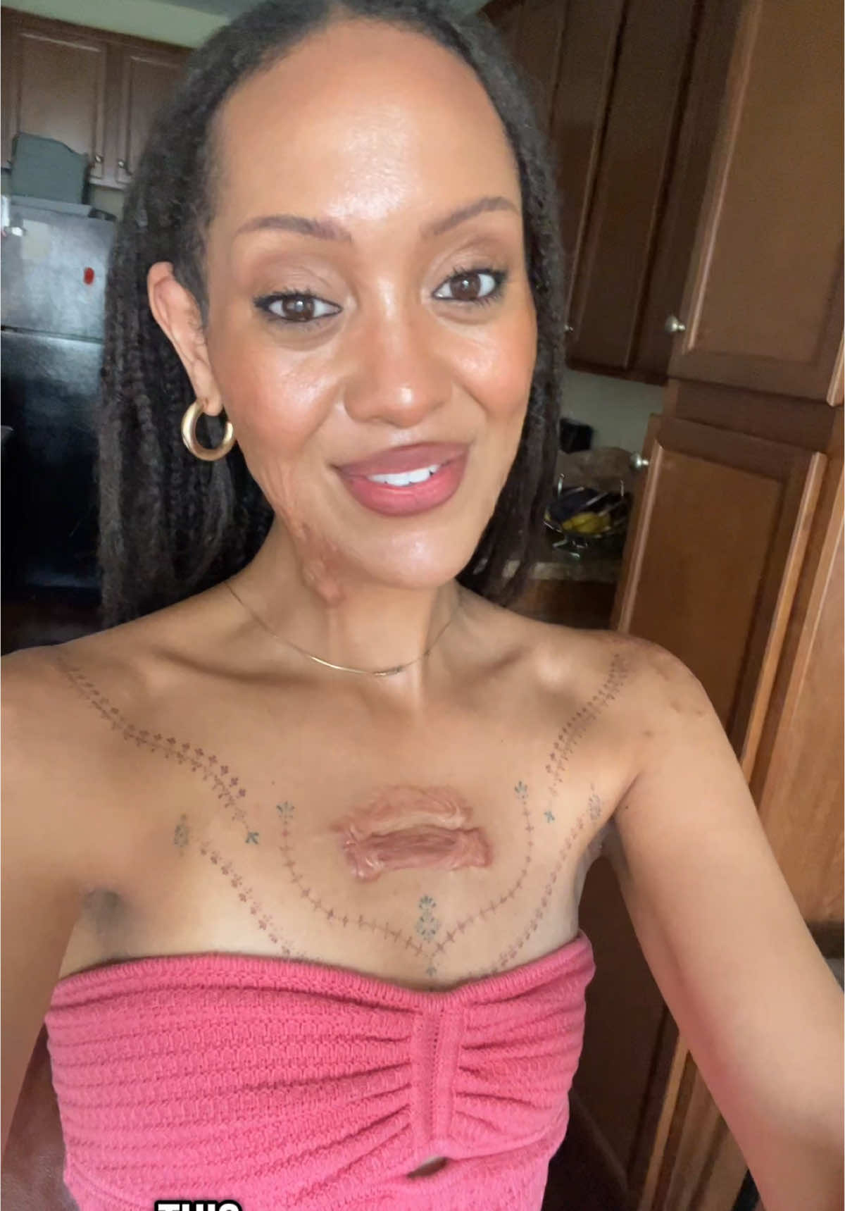 Replying to @Meg truly blown away by so many of you taking the time to help! It’s a little thing but it felt meaningful to me!  Here’s to #pink #fyp #thankyou #BlackTikTok #scars #coralpink #colortheory #colorseason 
