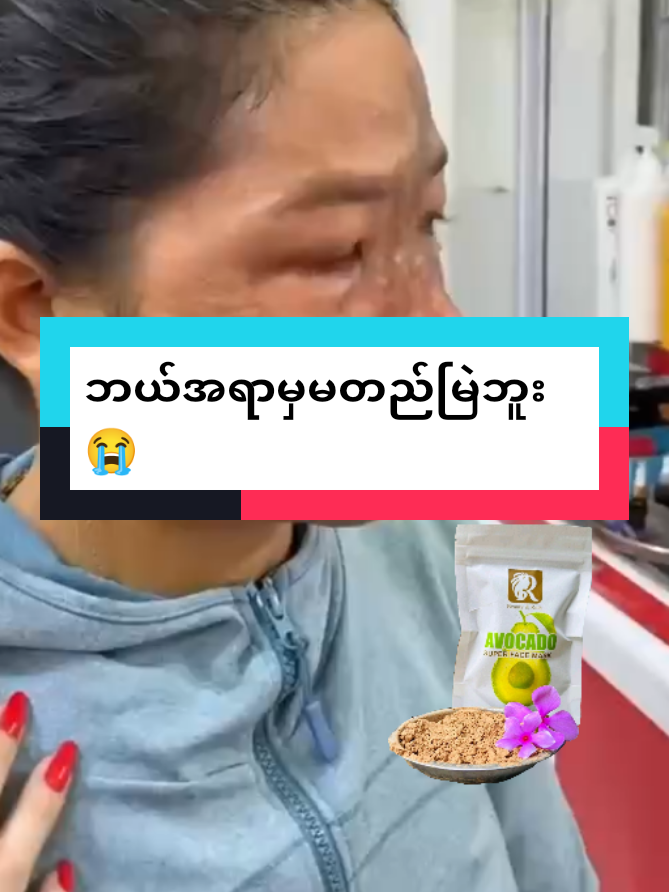 #ဘာဖစ်ဖစ်အားတင်းထားပါတယ်💪💪 #တင်းတိပ်ပျောက်ချင်သူများအတွက် #တင်းတိပ်အမဲစက်ပြောက်ချင်သူများအတွက် #facemask #avocadosupermask #avocadofacemask🥑 #foryou #foryoupage #tiktok #tiktokindia #tiktokmyanmar🇲🇲 #tiktok2025 #thinkb4youdo #flyပေါ်ရောက်စမ်း #တွေးပြီးမှတင်ပါ 