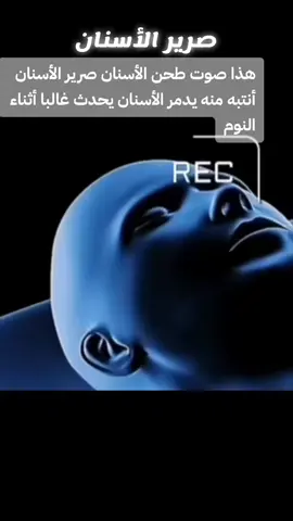 #صرير_الأسنان#صرير_الاسنان_اثناء_النوم #flypシ゚viral #vip #dentestry #تسوس_أسنان #هوليود_سمايل #تجميل_الاسنان 