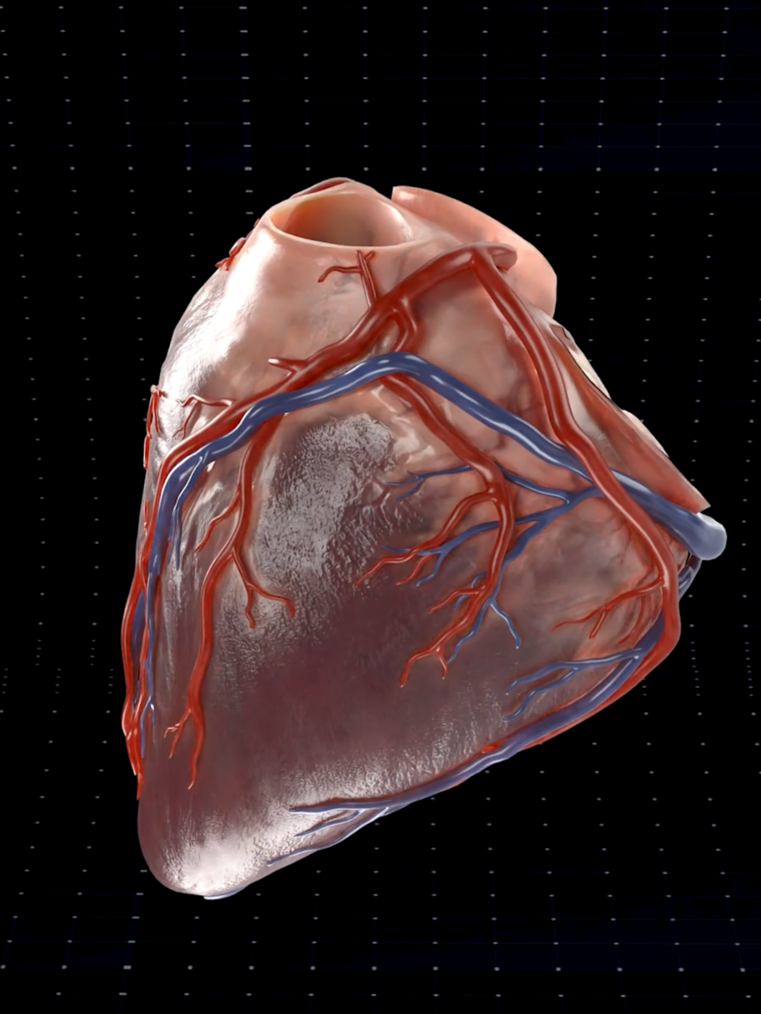 See the Heart Valves 🩺🫀 . . The human heart is a vital organ that pumps blood throughout the body, supplying oxygen and nutrients while removing carbon dioxide and waste products. Here are some key points about the human heart: Anatomy: The heart has four chambers: two upper atria and two lower ventricles. The right side pumps deoxygenated blood to the lungs, while the left side pumps oxygenated blood to the rest of the body. Valves: There are four main valves (tricuspid, pulmonary, mitral, and aortic) that ensure unidirectional blood flow through the heart and prevent backflow. Circulation: The heart is part of the circulatory system, which includes the pulmonary circuit (to and from the lungs) and the systemic circuit (to and from the rest of the body). Electrical System: The heart has its own electrical system, including the sinoatrial (SA) node, which acts as the natural pacemaker, regulating the heartbeat. Health: Maintaining heart health is crucial, as cardiovascular diseases are leading causes of morbidity and mortality. Lifestyle factors such as diet, exercise, and avoiding smoking play a significant role in heart health.💓. . . #smartdoctor1 #cardiology #anatomia #anatomía #education #anatomi #cardio #ANATOMY #anatomy #heartanatomy #medicina #3danimation #doctor #pregnancy #pulmonaryhypertension #pregnant #baby #gravidez #medstudent #animation
