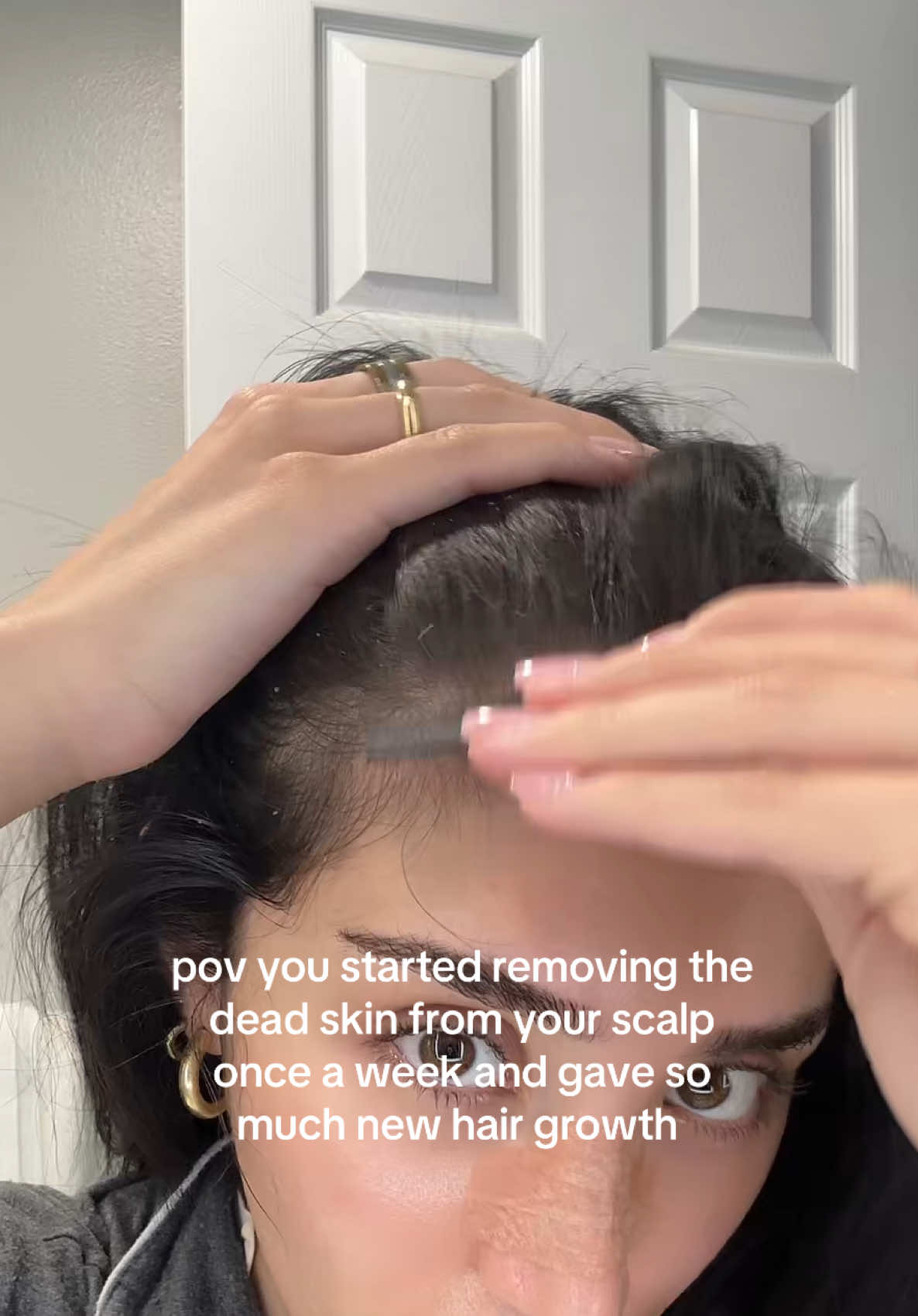 looks disgusting but the results from it is amazing and my scalp feels so much healthier also learned this trick from @Sonya Sed #hair #hairhacks #hairgrowth 