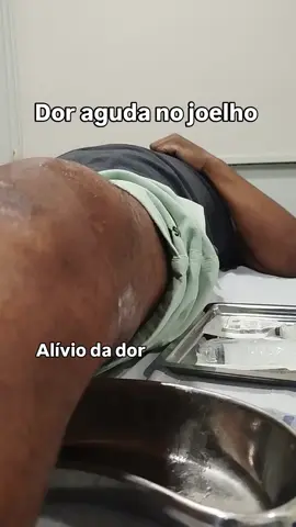 Teria coragem de fazer? Coloquei o vídeo a título de curiosidade. É um procedimento médico chamado artrocentese. Eu não faço esse tipo de intervenção, beleza? 🤝🫶#joelho #dor #Ortopedia 