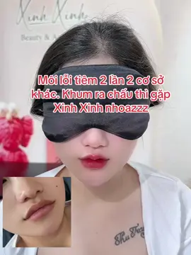 Môi lỗi tiêm 2 lần 2 cơ sở khác. Khum ra chấu thì gặp Xinh Xinh nhoazzz#CapCut #tiemmoi #xuhuong #tiemmoifiller #tiemma #tiemcam #thammy 