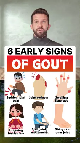 6 early signs of Gout #healthy #healthcare #healthtips #gout 