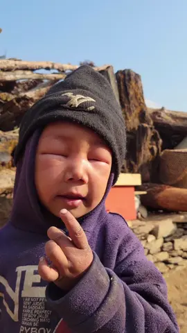 मौरिले टोकेको घरेलु औषधि केहि थाहा भाय जन्कारि पाउ है 