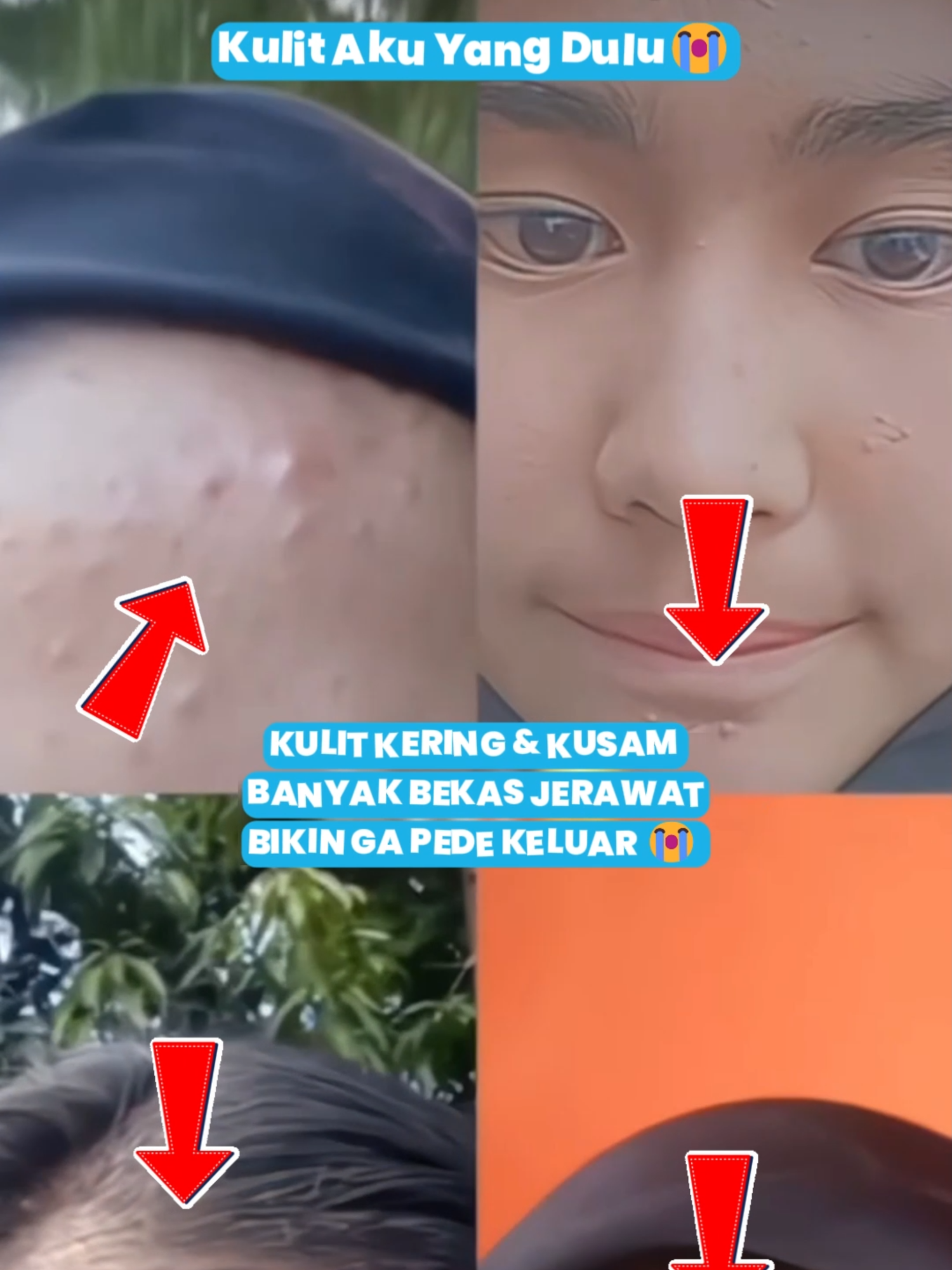 Glowing hemat, hasil mewah. Gak perlu mahal buat cantik! 💸💅#cleorabeauty #kulitglowing #kulitcerah #kulitkusam #bebasjerawat #moisturizer #superbeauty #superbeautyday #kulitberjerawat #diskon #kulitsehat