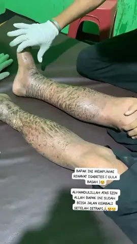 JAGA POLA MAKAN KALIAN YA JANGAN TERLALU MAKAN YANG MANIS BERLEBIH DAN HINDARI SELETAH MAKAN USAHAKAN JANGAN LANGSUNG TIDURAN KARNA DAPAT MENYEBABKAN DIABETES #pengobatanalternatif #totoksaraf #brahmanasanjaya #fyp 