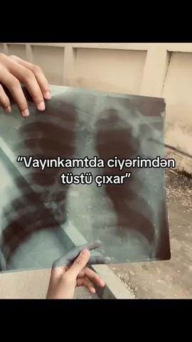 öleceysen bala 