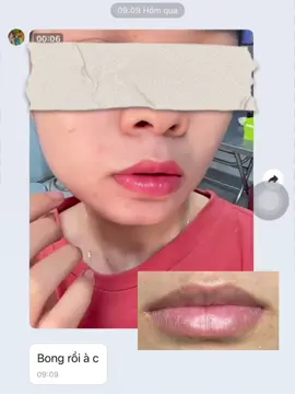 Feedback môi sau bong.. môi tươi tắn, bậc tone..10₫ hehee #phunmôiđẹpbìnhthạnh #phunmôiđẹpsàigòn #xuhuongtiktok #ilovetiktok #khửthâmmôisàigòn 