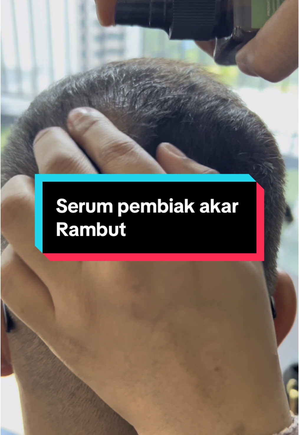 Serim pembiak Akar rambut #serumrambut #serumrambut #serumrambutgugur #ConSantanderConecto 