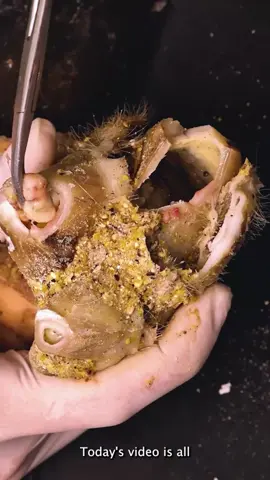 Unbelievable Toenail Fix in the USA! 🇺🇸 #USA #AmericanToenail #ToenailCare #SatisfyingNail #NailFixUSA #AmericanHealth #USAToenailCare #MadeInUSA #TrendingInUSA Disclaimer: These videos are sourced from other platforms, Video Credit to Vietnamese group. They feature artificial toenails for educational and monetization purposes.