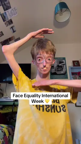 #fyp #fypp #fypsounds #trendingnow #trends #getmefamous #fyppage #getmetiktokfamous #trendingsound #viralnow #goviralgo #trendingtopic #trendingtiktoks #tiktokviral #viral #foryoupagе #faceequality #faceequalityweek #changingfaces #disability #disabilityawareness #disabilitytiktok #disabilities 