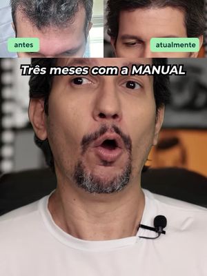 Queda de Cabelo tem tratamento!