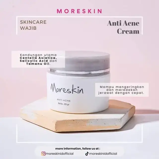 Semangat Pagi Morefams! 🤗🥰 Minski mau ngasih solusi nih bagi kalian yang suka gemes karena muncul jerawat, bisa di redakan menggunakan *Moreskin Anti Acne* 😍 Pemakaian *Moreskin Anti Acne* ini simple banget loh, cukup di pakai saat malam dan di totol pada area berjerawat setelah melakukan skincare routine! 🥰 Inget ya Morefams, jerawat jangan di pencet apalagi di pegang yaa! Cukup di totol dengan *Moreskin Anti Acne*, jerawat hempas deh 🥰❤️ #stokisnasa #kendari #tokoherbal #YukDiOrder #fyp #fypシ゚ 