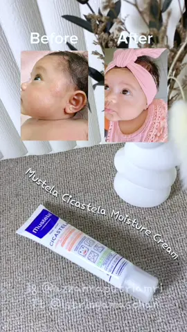 Satu bulan yg lalu Xaviera beruntusan parah di area pipi, telinga sampai ke belakang telinga, untung ada Mustela Cicastela Moisture Cream yg bisa menghilangkan kemerahan di area wajahnya🥰 2 Hari kemerahan itu langsung hempaassss, emang the best banget ini produk🫶🏻 #beruntusanbayi #kemerahanpadakulitbayi #mustelaindonesia #mustelacicastela #mustelacicastelamoisturecream 