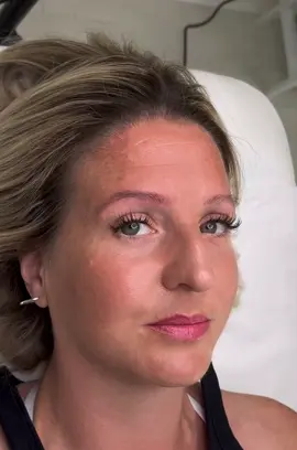 Microblading session #brows #browartist #eyebrows #eyebrowshaping #fyp #stamford #foryou #beauty #salon #stamfordlincolnshire #microbladingbrows #microblading #eyebrowtattoo #tattoo