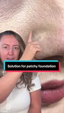 The solution to cracked and separating foundation. The @Maybelline NY grippy serum primer #makeup #makeuptips 