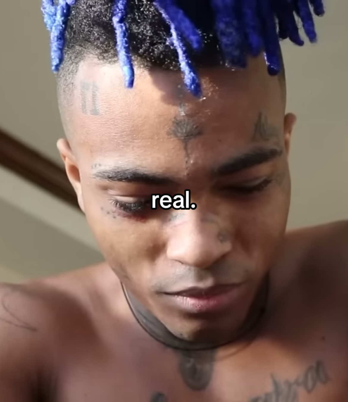 the only rapper that cared about his fans #xxxtentacion #foryoupage #jahsehonfroy #fyp #viral #sklglobes 