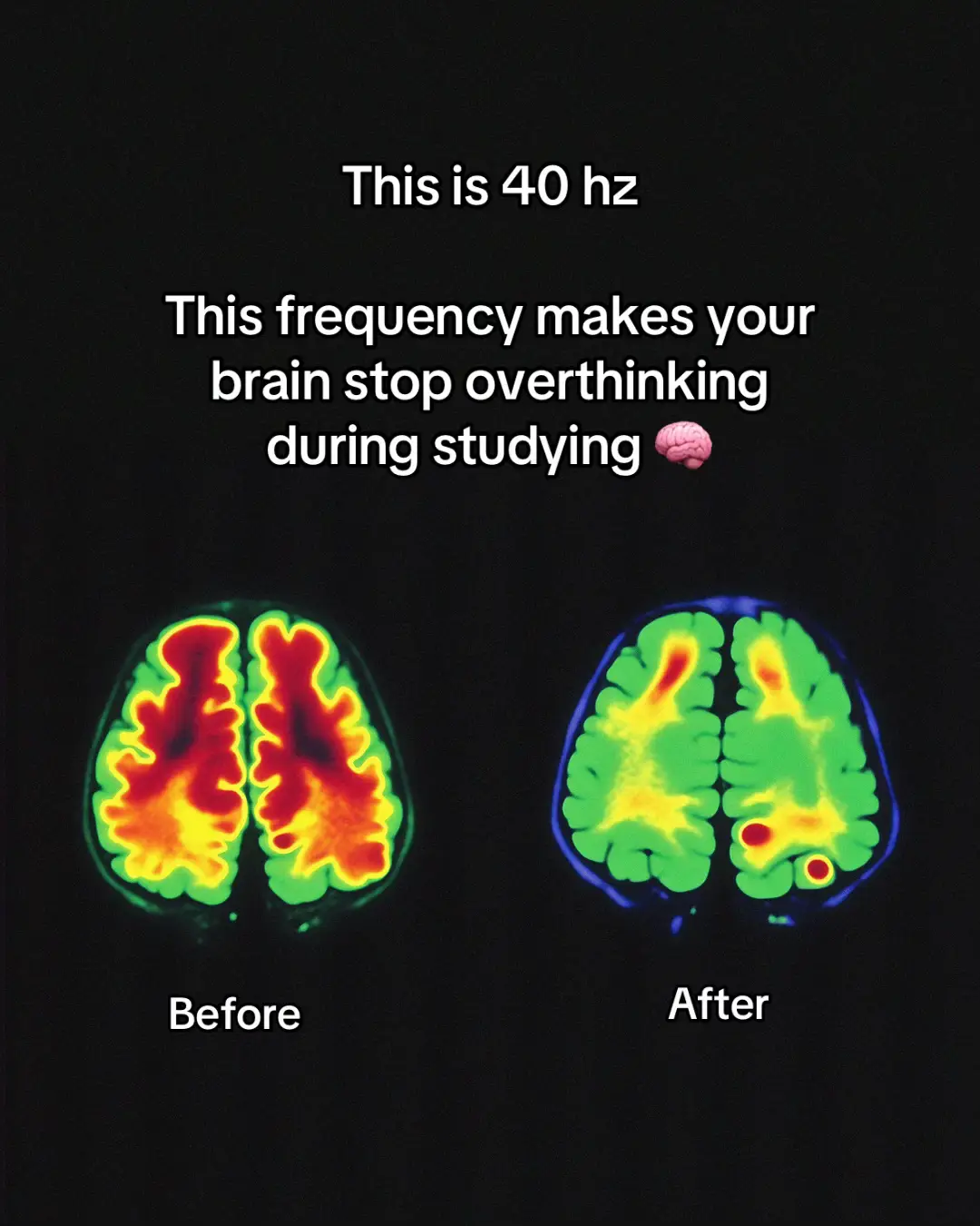Binaural beats 40 hz #studytok #student #study #binauralbeats #frequency #studying 