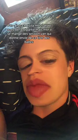 Ça calvitie précoce la #humour #pourtoii #foryou #trend 