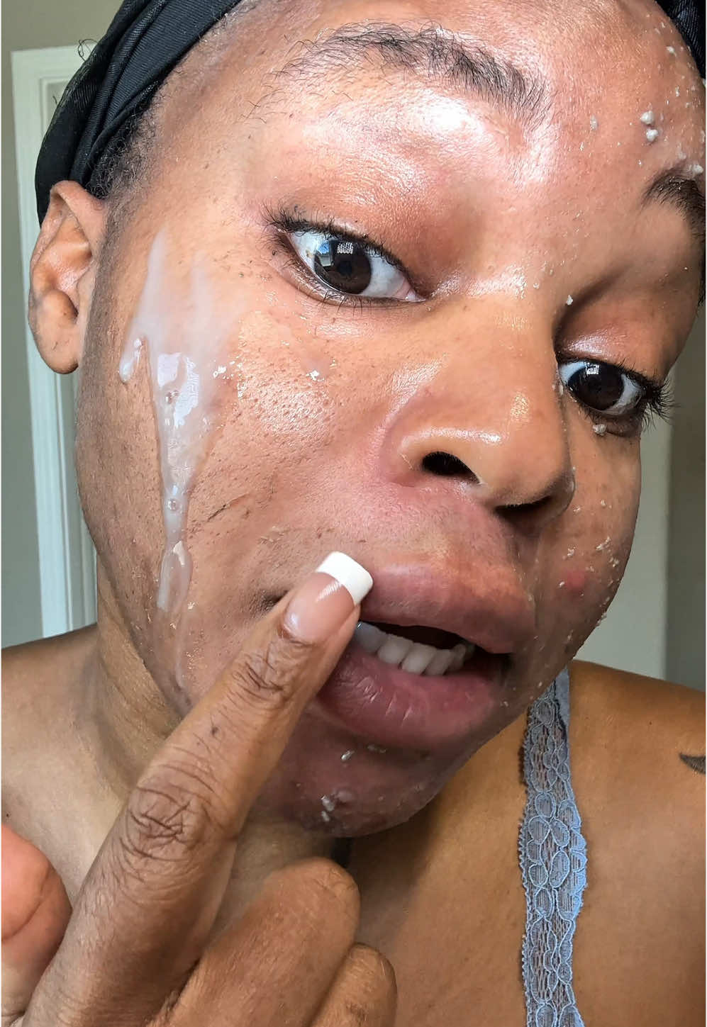 Never have I ever had a product that works this well 🔥 #skincare #skincareroutine #chemicalpeel 