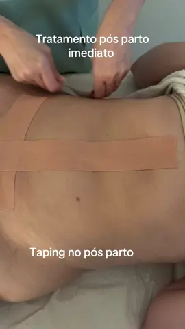 O taping pós-parto oferece diversos benefícios para as mulheres, incluindo alívio de dor, redução de inchaço, suporte para a musculatura abdominal e auxílio na cicatrização. Ele pode ajudar a melhorar a circulação, reduzir a sensação de 