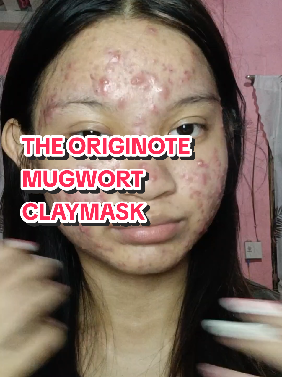 Replying to @ayo_butterfly  hereee mgaa bebe hope it helpss!   #fyp #GlowUp #acne #acneproneskin #acnefighter #texturedskin #claymask 