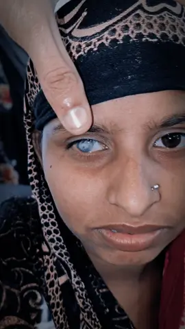 Comment your diagnosis 🧐 #retina #oftalmo #ophthalmology #oftalmologia #oftalmología #ophtalmologie #офтальмологія #офтальмология #οφθαλμολογία #ophthalmologists  #eyehealth #vision #eye #zeissbrasil #visulasgreenbrasil #clarusbrasil #retinography #visulas #med #meded #eyedisease #medicalschool #medicalstudent #Science #retina