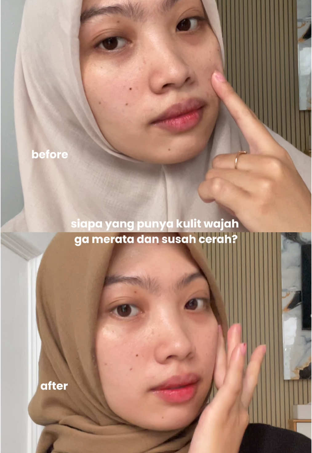 worth to try juga kok buat yg kulitnya sensitif 😍 @GMEELAN.Official.Shop @GMEELAN_INDONESIA #glabidrincream #gmeelanindo #gmeelan 