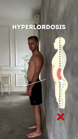Feel like your lower back is arching too much? It could be a sign of hyperlordosis — and your posture might need a reset. Here’s a quick drill I use daily: 👉 Posture Calibration It helps you realign your spine and train your body to hold that alignment throughout the day. Do it anytime you feel off balance or notice your posture slipping. With consistency, it becomes second nature to stand tall and support your lower back. ✅ Small habit → Big results #PostureFix #Hyperlordosis #SpineHealth #MobilityRoutine #BackCare #PilatesMoves #PostureMatters #CoreAwareness