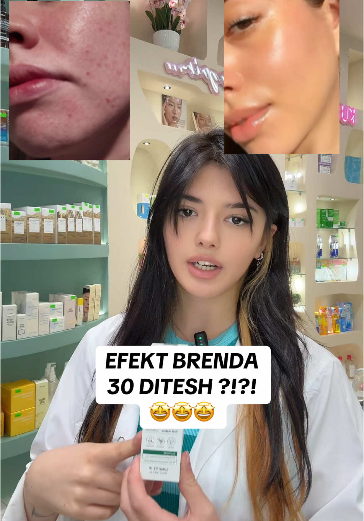 EFEKT BRENDA 30 DITESH 🤩#foryoupage #viral_video #🇦🇱 #kfarmaal 