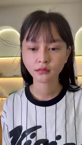 Căng chỉ siết cơ nâng cơ thon gọn mặt #filler #xuhuongtiktok #cangchi 