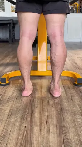 Flat feet, also known as pes planus #flatfeet #pesplanus #Fitness #gym #healthy #healthylifestyle #recovery #rehabilitation #wolfpak 