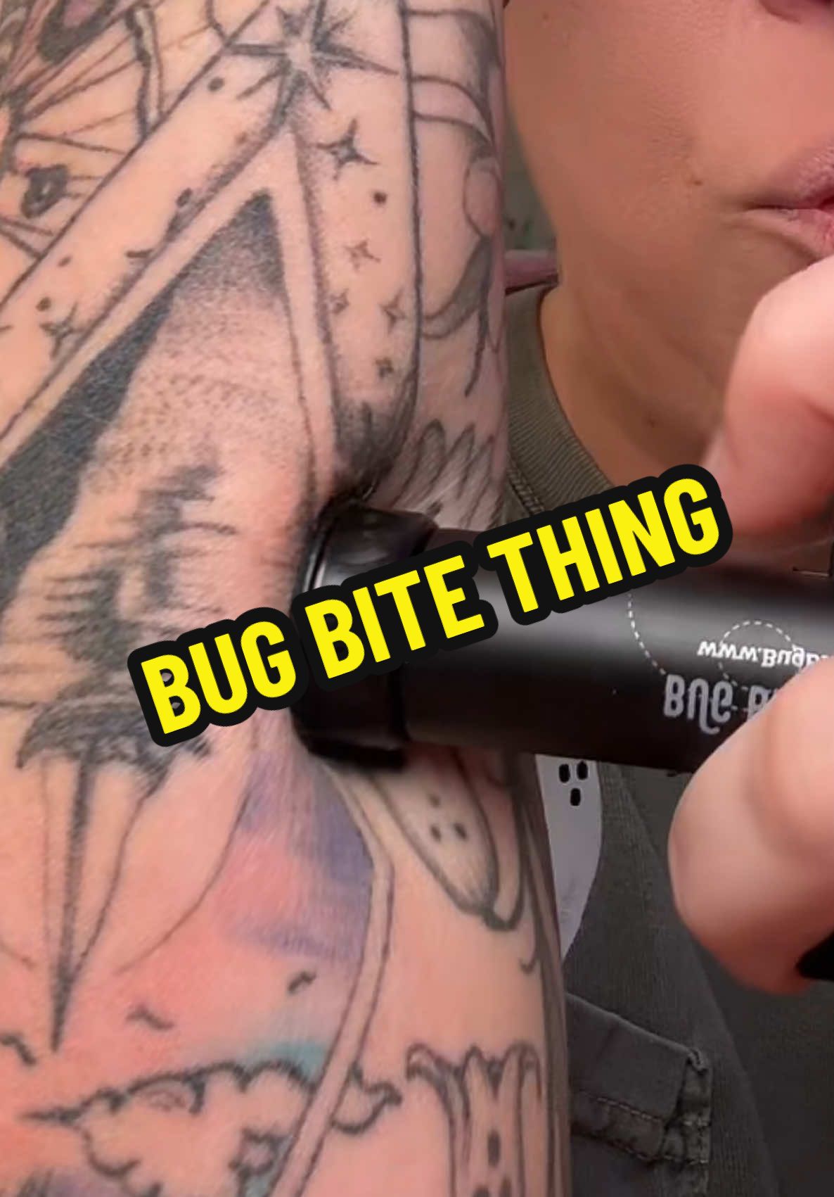 If you have kiddos and you spend any amount of time outside- you should really have a @Bug Bite Thing on hand during the summer. Mosquitos flock to me like no one’s business. And then I end up with a huge welt. I didn’t know these existed until last year but it’s worth trying with how inexpensive they are #bugbite #mosquitobite #bugbitething #sting #beesting  #mommusthaves 
