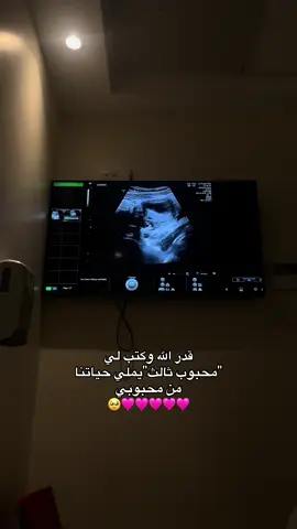 الحمدلله 🤍. #ماشاءالله #بناتي#مولوده#سونار#محبوبي#بنت#مالي_خلق_احط_هاشتاقات 
