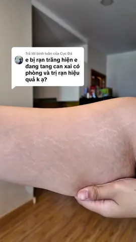 Trả lời @Cục Đá rạn trắng lâu năm là dạng khó cải thiện nhất, nhưng có KH dùng 2-3 tháng là thấy mờ rõ rồi. Nếu kiên trì và bôi đều đặn 2 lần/ ngày thì sẽ cải thiện được nhiều lắm nha #goclamdep #RạnDa #kemranda #ovelaabera 