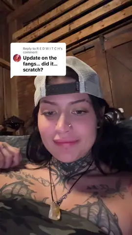 Replying to @R E D W I T C H where are my tmj baddies and who can give me advice plz (don’t suggest an oral surgeon, i’m going to see one, and i have botox in for it already hahaha) 